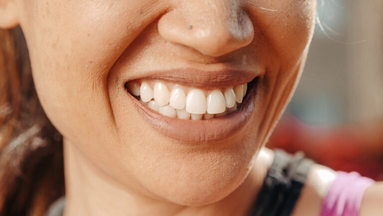 Smiling patient showing healthy teeth