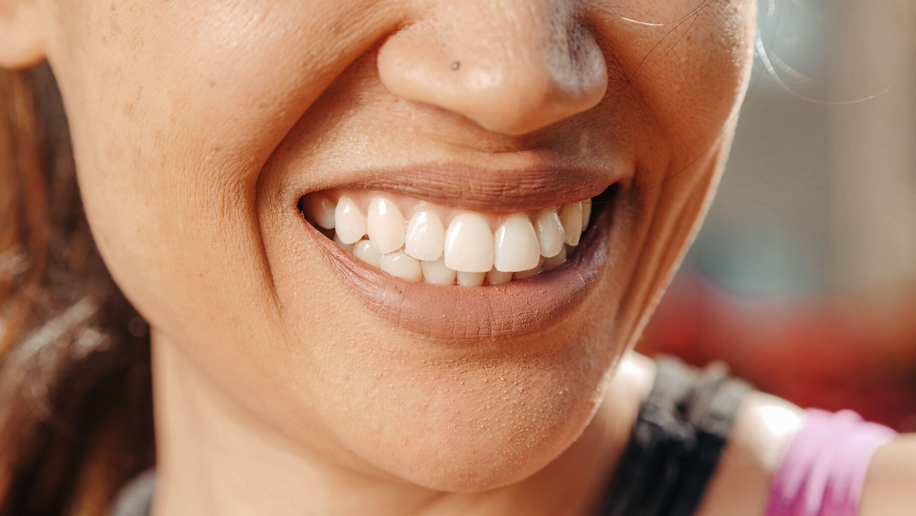 What to Know About Professional Teeth Whitening